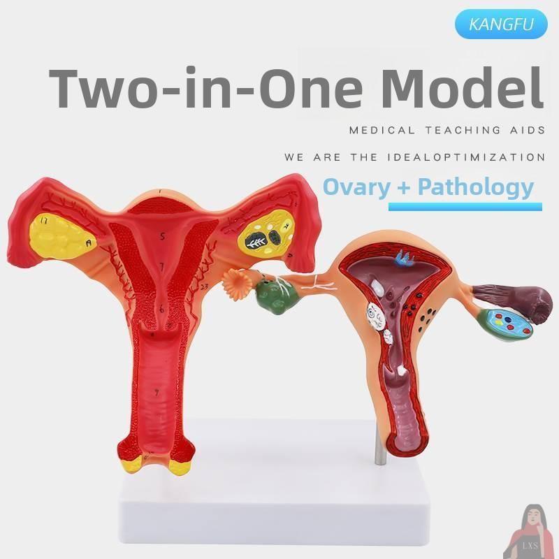 Amical Pathological Model of Human Fem Reproductive Uterus Teaching Model of Vagina Ovary for Gynecological Reproducti...