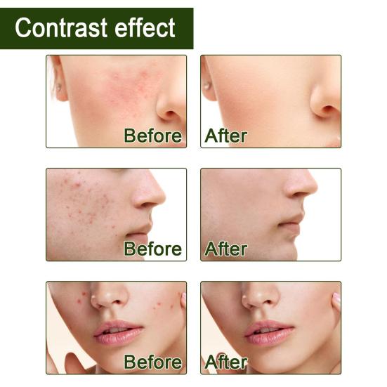 Здоровая сыворотка для лица, жидкая, быстро впитывающаяся, нежное омолаживающее действие.