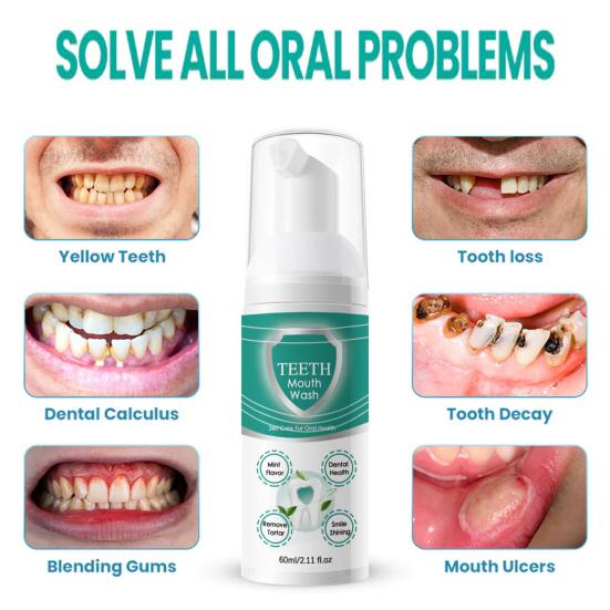 60 мл жидкость для полоскания рта для полоскания рта, устранение неприятного запаха изо рта, удаление зубного налета, удаление пятен, десен, уход за полостью рта, глубокая очистка, мятный вкус, отбеливание зубов, жидкая пена