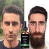 Beard Oil Hair Oil for Fast Hair Growth Beard Hair Growth
