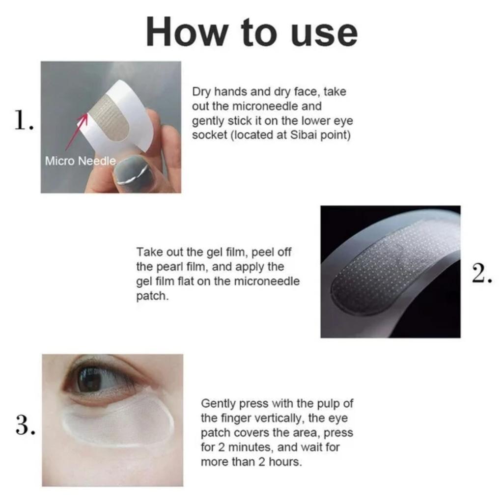 Гиалуроновые микроиглы для глаз, удаление морщин и тонких линий, 1 мл