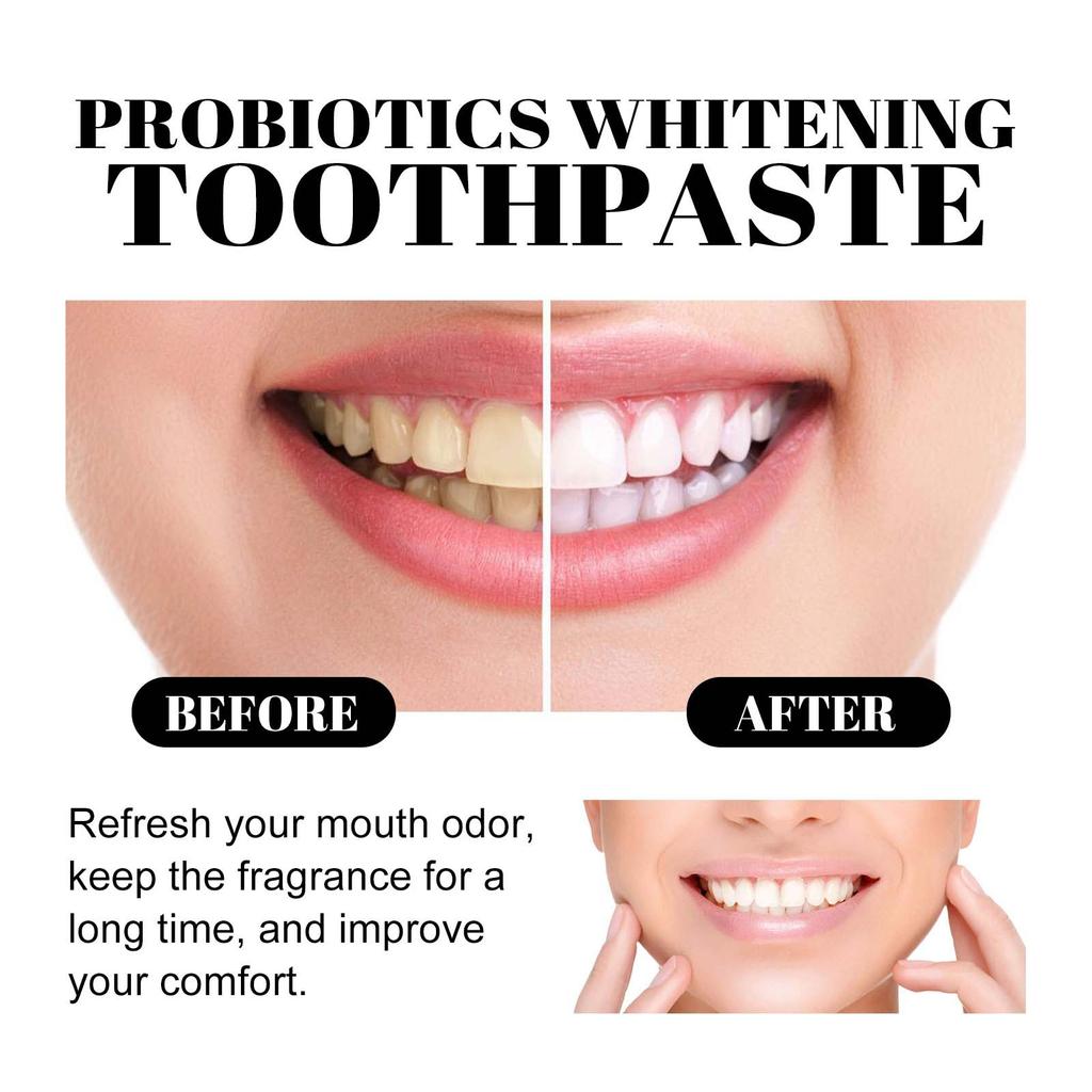 Eelhoe Teeth Cleansing Stains Removes Breath Freshen Teeth Whitening Mousse Oral Hygiene Mousse Foam Portable Travel Toothpaste 150ml