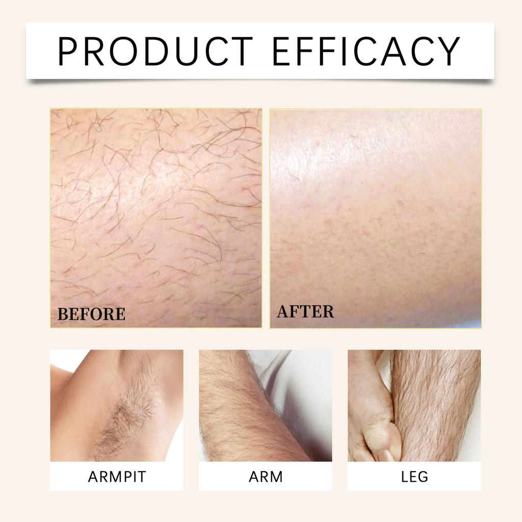 Набор для удаления волос, удаление волос на лице для женщин, удаление волос на теле, депиляция для лица, рук, ног и бикини, бальзам для удаления волос, скребок для волос 100 г