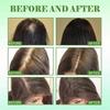 2pcs Hair Regrowth Serum | Natural Hair Growth Treatment | Essential Oil Repair Care