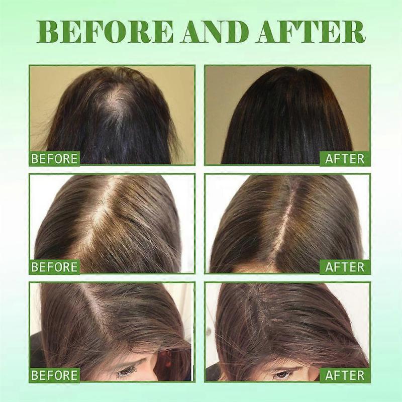2pcs Hair Regrowth Serum | Natural Hair Growth Treatment | Essential Oil Repair Care