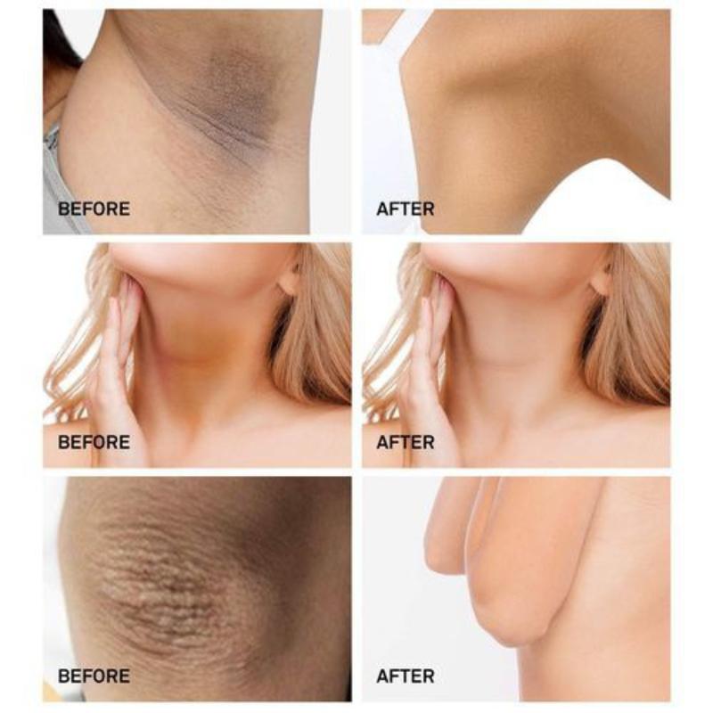 Whitening Cream Under Arm Dark Skin Legs Knees