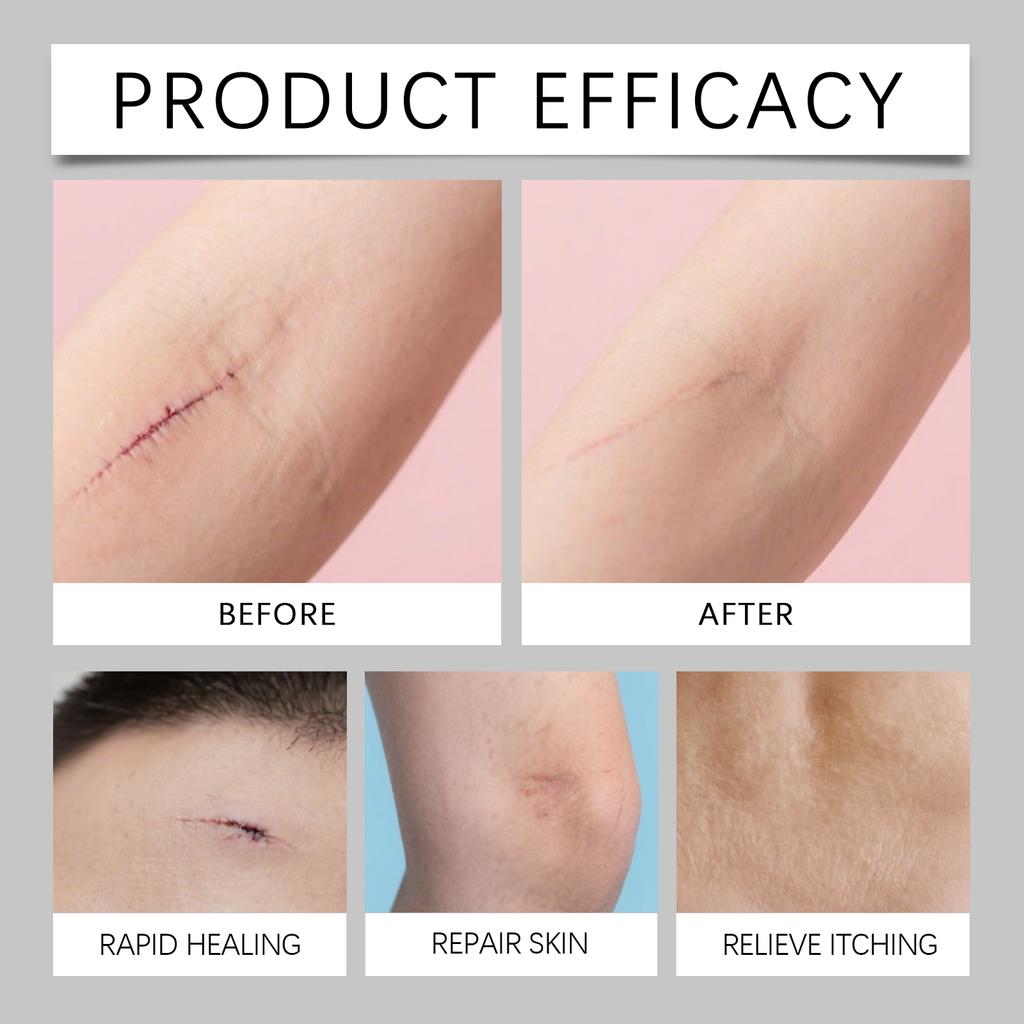 Skin Scar Moisturizing Care Stick: Smooths the Appearance of Skin Scars. Daily Care Cream