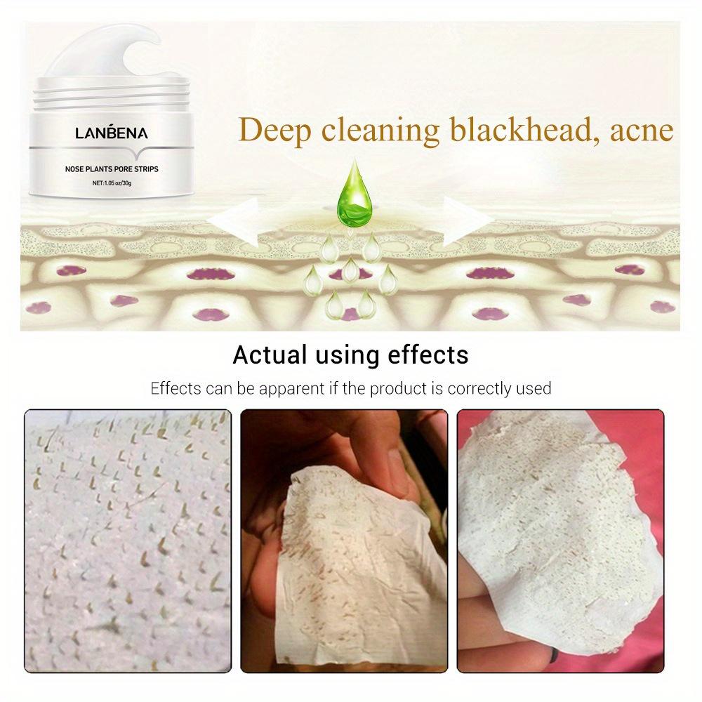 Маска для носа для удаления черных точек Lanbena Pore Strip Черная маска Пилинг Лечение прыщей Уход за кожей