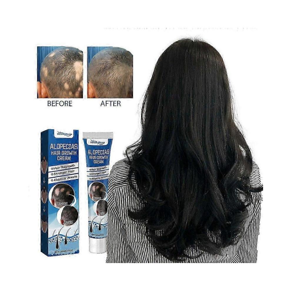 (2 pcs)1-3x New Alopecia Cream Growing Alopecia Baldness Regrowth 20g