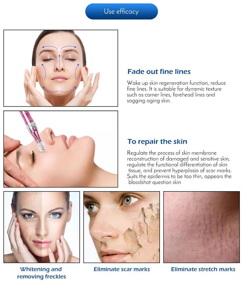 Rechargeable Rose Electric Microneedle Pen for Skin Rejuvenation and Hyaluronic Acid Treatment.