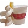 BoNew-Oral 1:1.5 Anatomical Human Lumbar Vertebrae Degenerative Lumbar Human Spine Model White Color