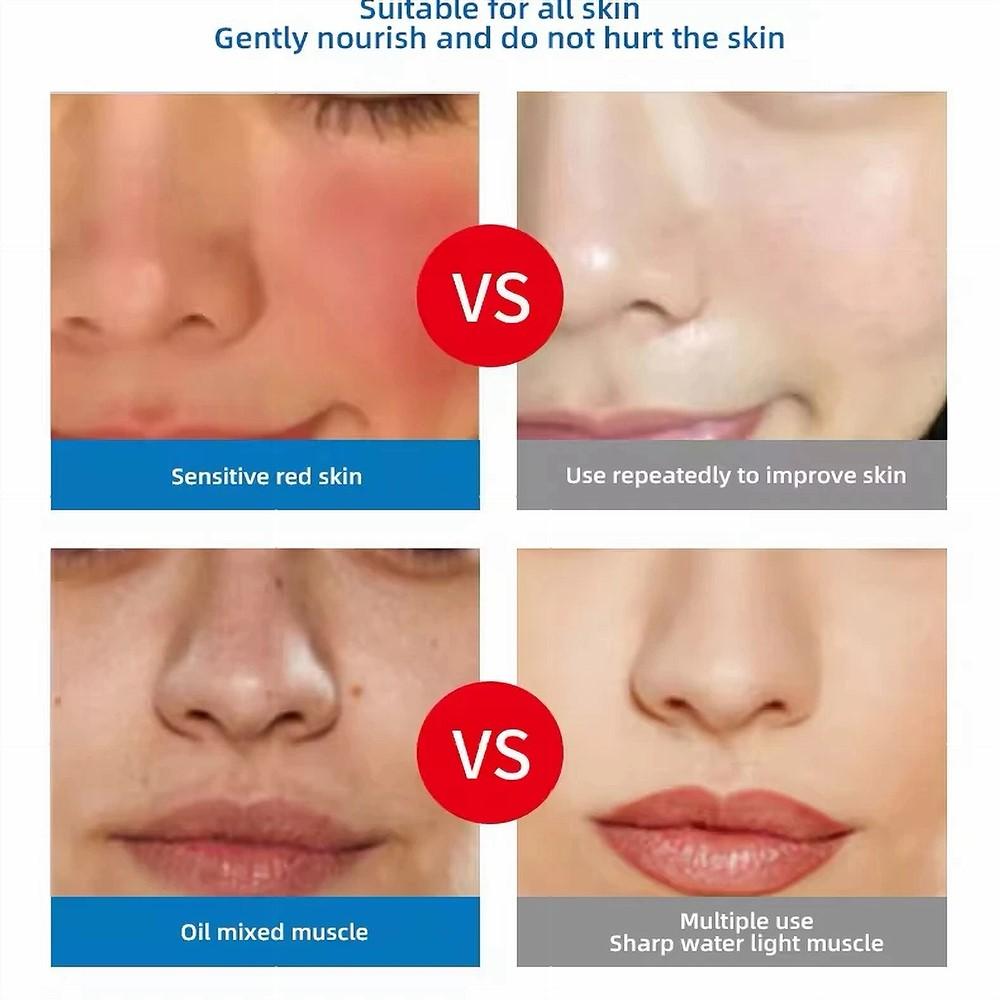 Home Use Water Mesotherapy Gun Deeplyhydrate EZ Negative Pressure Meso Gun Mesotherapy Hydrolifting Water Injector Beauty Device