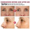 Moisturizing Eye Cream EELHOE Retinol Stick Renewing & Firming Under Balm for Dark Bag Remover Circles, Puffiness, Fine Lines Wrinkles Travel