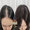 Natural Herbal Essence Anti-Hair Loss Hair Serum For Thinning Hair Thickening and Reawakening