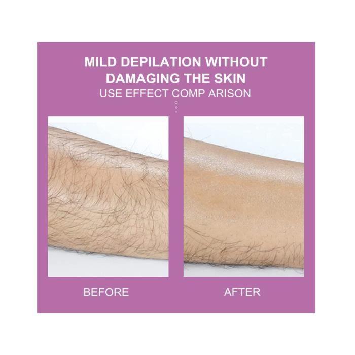 Épilateur - Crystal Hair Eraser - Indolore - Hypoallergénique - Noir - Épilation Physique