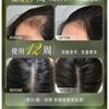 ZOOLY - No.1 Anti Hair Loss Scalp Care Shampoo - 2 Sizes