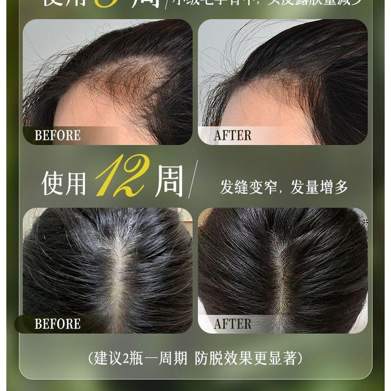 ZOOLY - No.1 Anti Hair Loss Scalp Care Shampoo - 2 Sizes