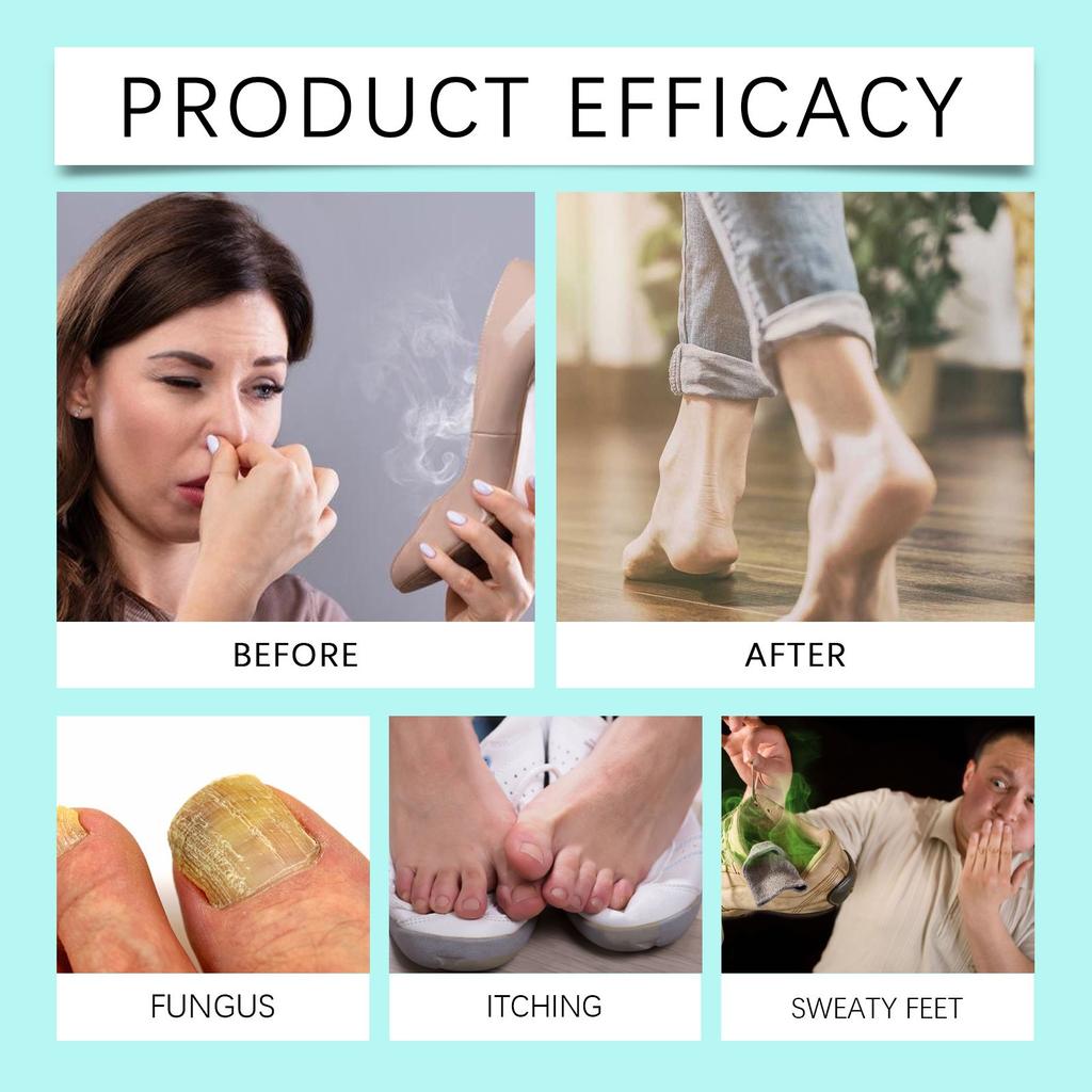 Foot Spray Itch Sweat Odor Exfoliating Sprayer Men Women Anti-fungi Shoe Sock Deodorant Feet Care Liquid 60ml