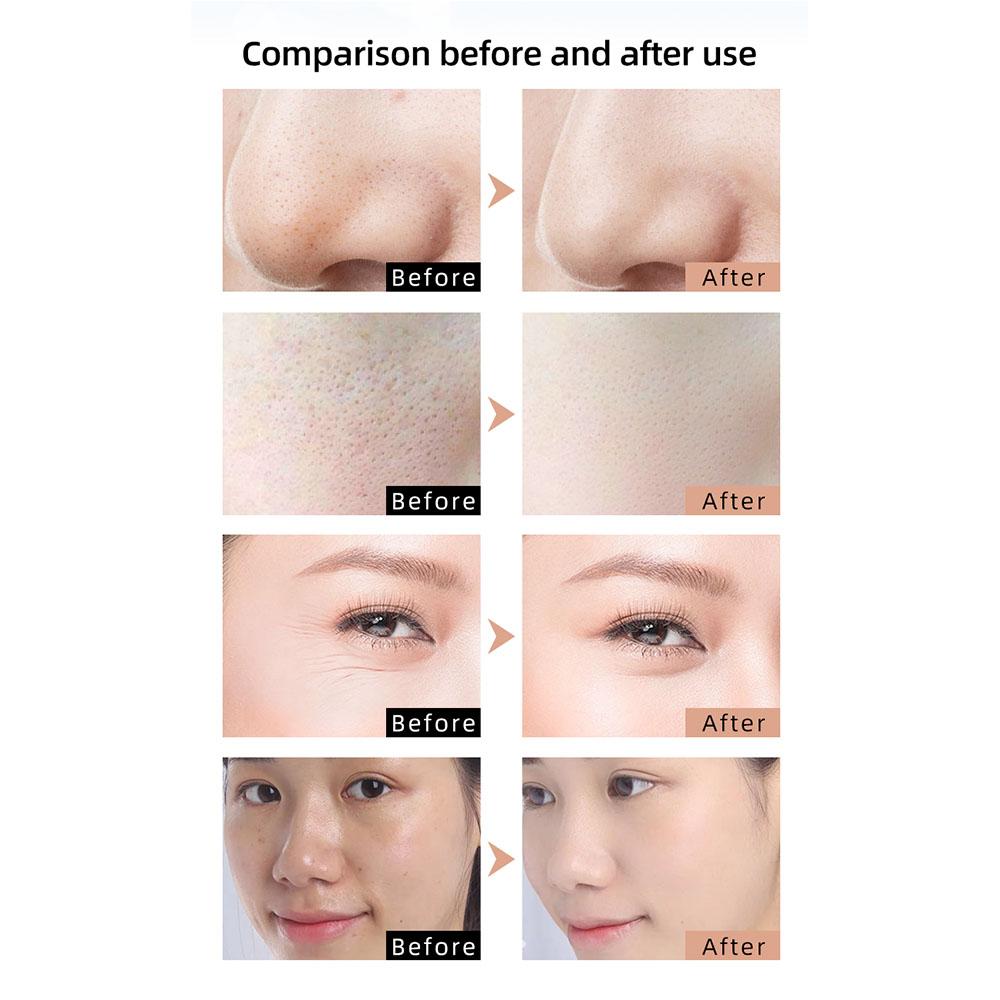 LED Photon Infrared Beauty Mask, USB-Powered Skin Care Device, Reduces Fine Lines & Brightens Skin Tone, Silicone Facial Rejuvenation Mask