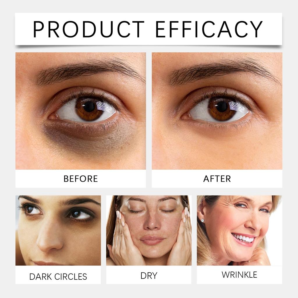 Ретиноловый крем для глаз Увлажняющий и укрепляющий крем для глаз предназначен для темных кругов и мешков под глазами, 50 г