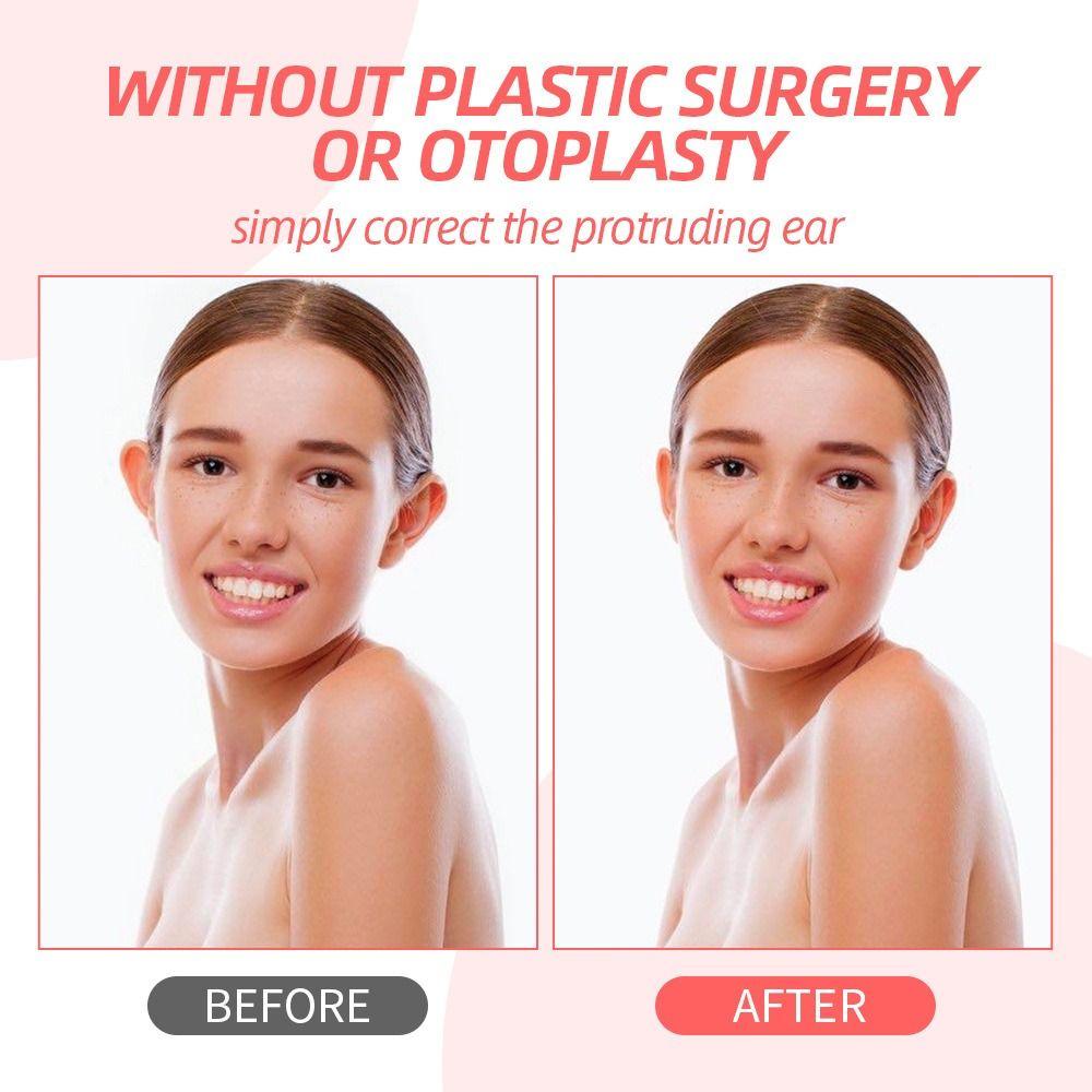 2/4/6/8 шт. без хирургического вмешательства, корректор для ушей, прозрачная невидимая лента для ушей, расширяющийся корректор для ушей