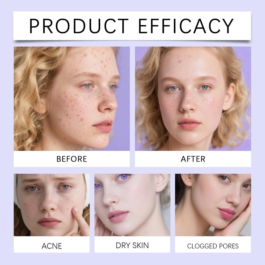 Tea Tree Oil Salicylic Acid Acne Patches Pimple Covers Non Irritating Overnight Healing Daily Skincare Travel Friendly Holiday