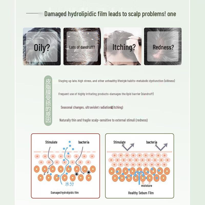 Sunsilk White Tea Anti-Dandruff Oil Control Shampoo