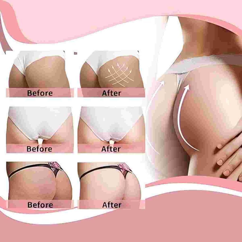 Hip Lifting Cream Tightens the Inner Thigh Muscles, Whitens and Brightens the Skin, and Is a Moisturizing and Hydrating Moisturizer