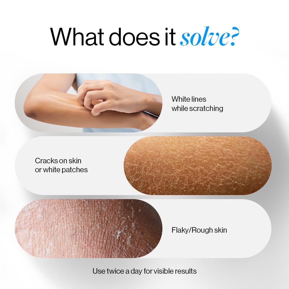 Be Bodywise Лосьон для тела с 10% мочевины 200 мл | Увлажнение на 48 часов для сухой кожи | Для очень сухой и шелушащейся кожи | С керамидами, маслом семян кокума и манго | Нежирный