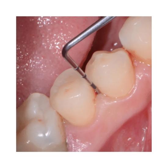 GDC Одноконтактные зонды Скрининговый зонд (Кто зонд) # 6 (Pcp11.5b)