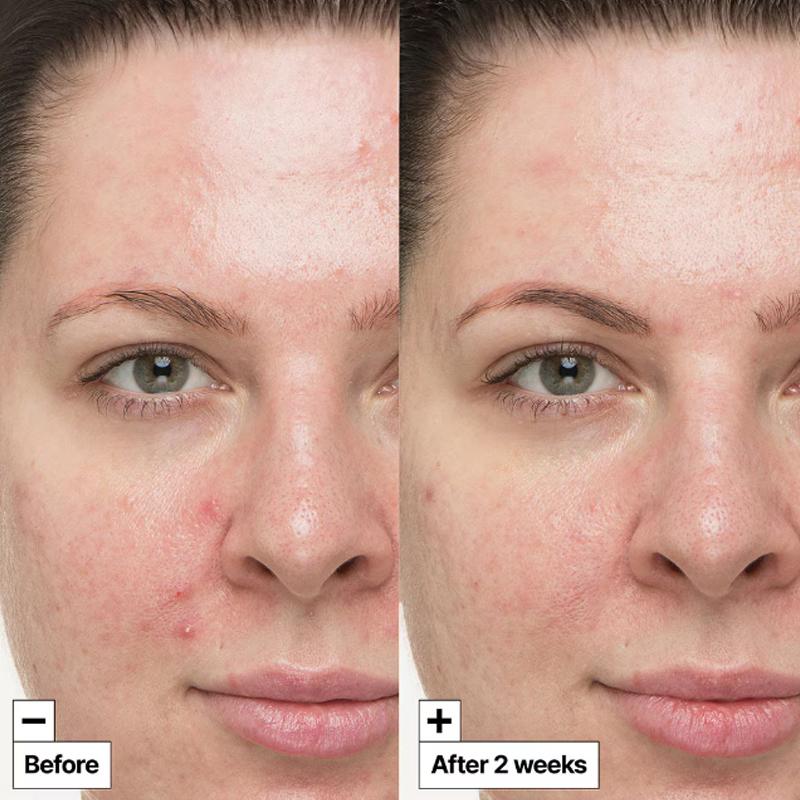 Корейская уходовая косметика сыворотка