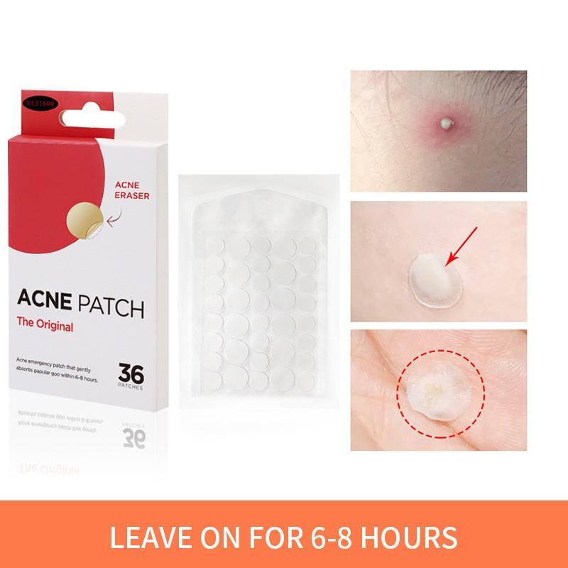 Cross-border Hydrogel Acne Pimple Patch