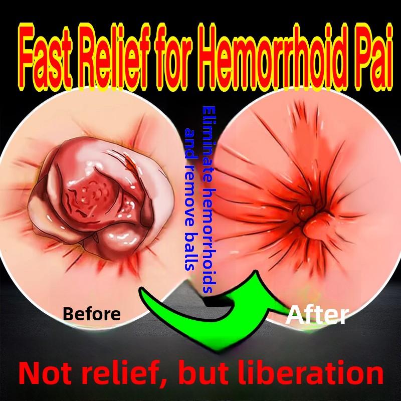 Тайская успокаивающая мазь от геморроя 55 г - Быстрое облегчение при внешнем дискомфорте, Улучшенная версия