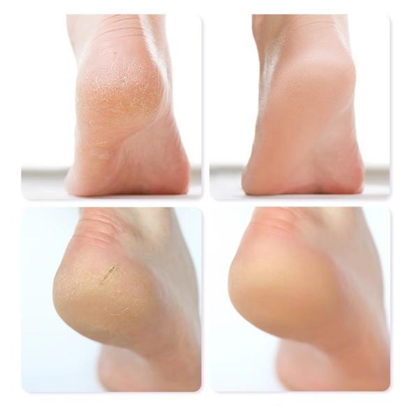 Sucoco силиконовые увлажняющие носки для ухода за ногами, телесного цвета, 1 шт., 2 шт.