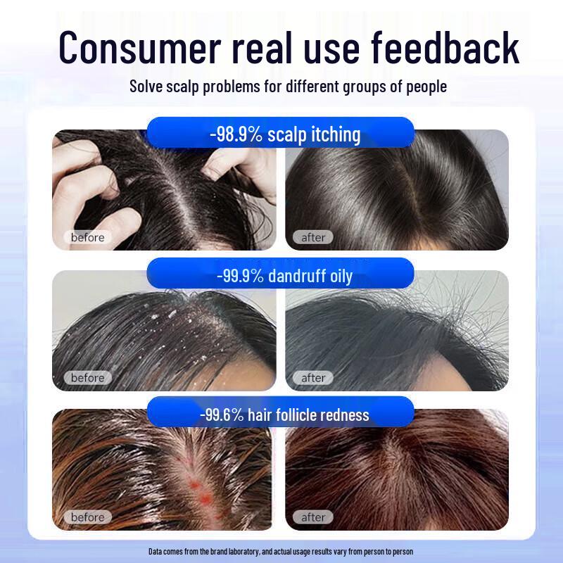 Nanjing Tongrentang Selenium Disulfide Anti-Dandruff Shampoo
