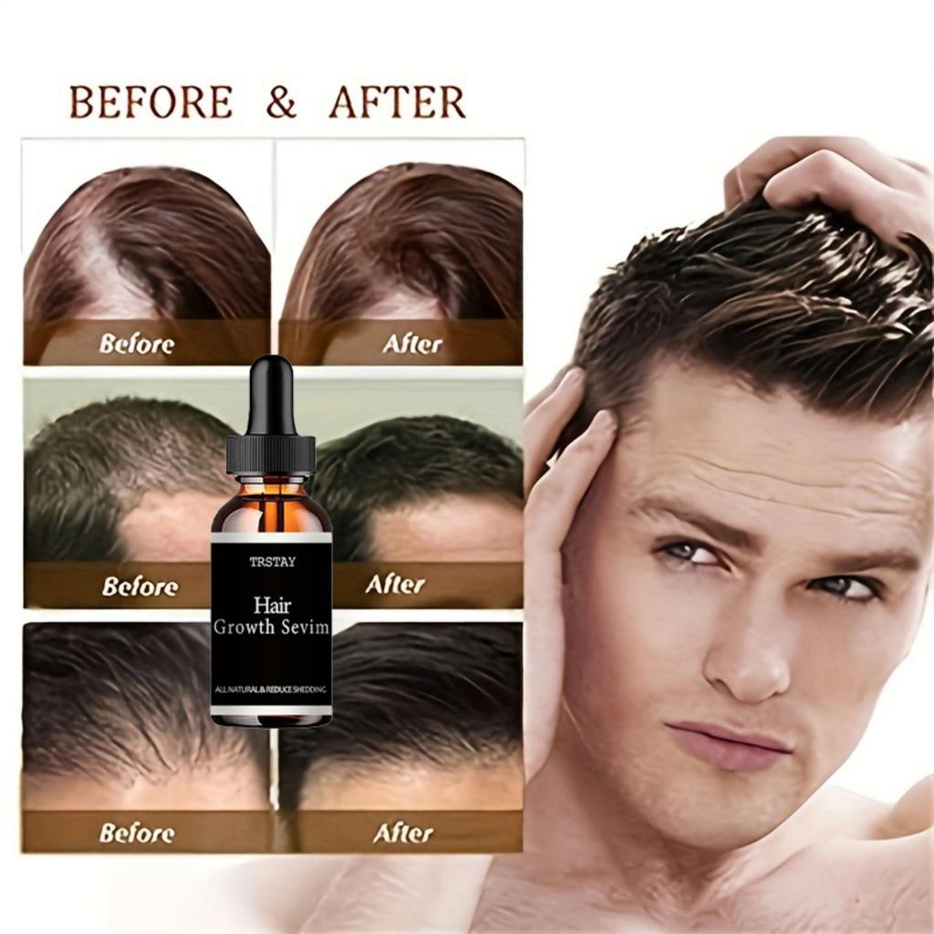 5 мл/15 мл/30 мл/50 мл/марокканское масло Эфирное масло для волос, уход за секущимися сухими и спутанными поврежденными волосами, делает волосы мягкими и блестящими