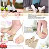 FYDUN Bunion Corrector Hallux Valgus Bunion Corrector, Yctze Pharmacy Orthosis Sleeve Protector