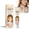 Vitiligo Cream, Natural Vitiligo Ease For Skin Vitiligo, Vitiligo Care Cream, Reduce White Spots And Improve Skin Pigmentation, Easy To Use