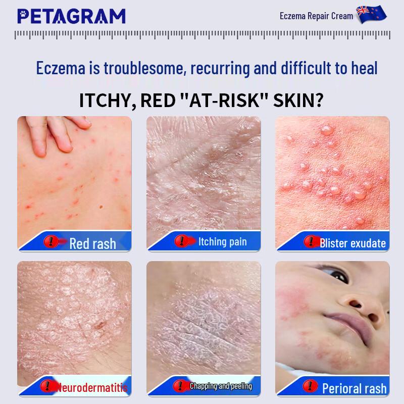 PETAGRAM Eczema and Anti-Itch Cream