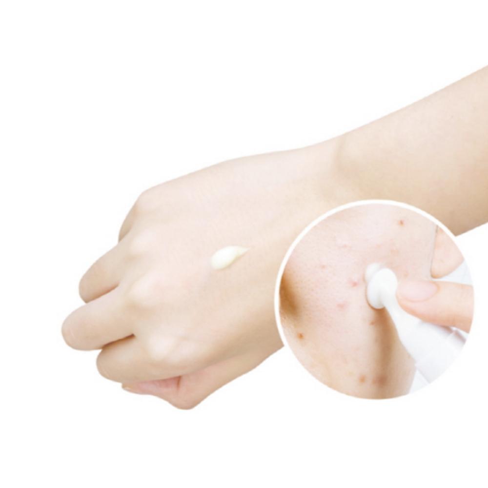 Крем YADA Anti-T Red Zero Spot, 15 мл, 1 шт.