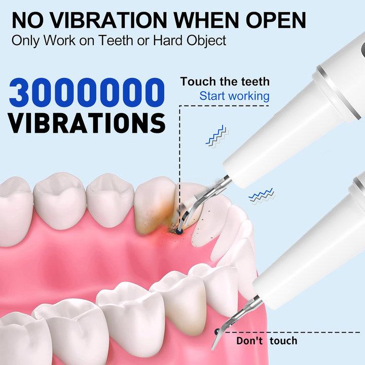 New Ultrasonic Electric Tooth Cleaner for Home - Removes Calculus and Cleans Teeth