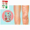 Foot gel for leg fatigue, swelling "HEALER", 70 g varicose veins - a universal assistant to the legs