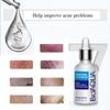 30 мл отбеливающая и анти-акне эссенция для лица, увлажняющая и жирная сыворотка для лица