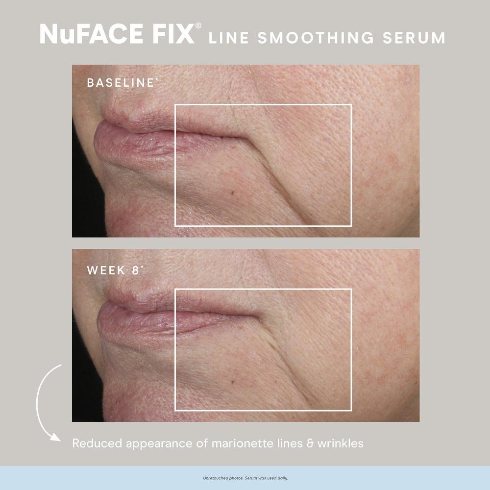 Nuface Line Smoothing Fix Сыворотка с тройным пептидным комплексом 0,5 унции