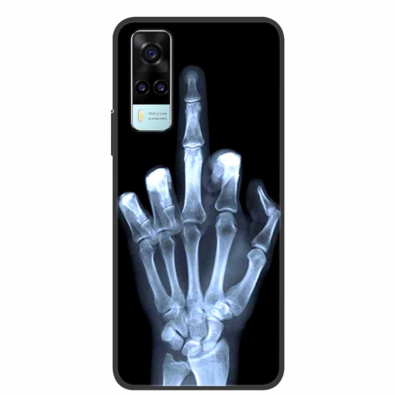 Чехол для vivo Y31 2021 Ударопрочный Мягкий силикон ТПУ Задняя крышка Для Vivo Y53S 4G Y31 2021 Y 31 Чехол V2036 Чехол для телефона Милый мультяшный