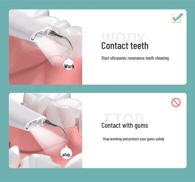 Портативный ультразвуковой очиститель зубов - Устройство для удаления зубного камня и отбеливания