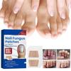10/30/60pcs Toenail Fungus Patch, FastActing Nail Care Patch For Fungus Under & Around Restores The Healthy Appearance Of Nails