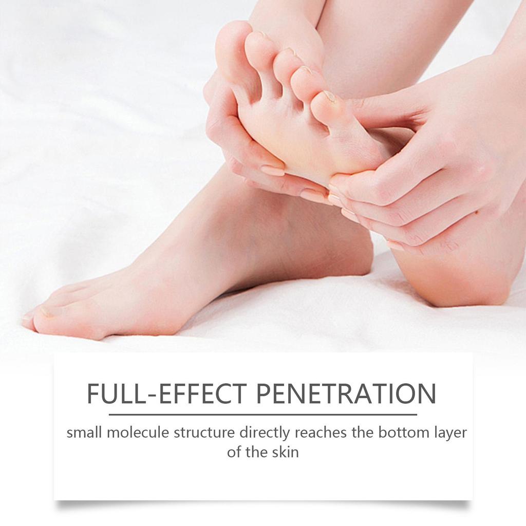 20 г Крем для ног против трещин Крем для восстановления потрескавшейся кожи Сухость Пятки с трещинами Шелушение Восстановление Маска для ног Питательный Смягчающий Увлажняющий Лосьон