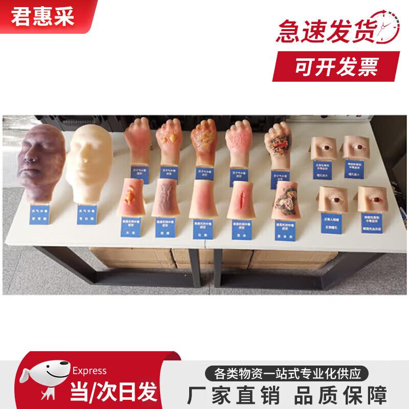 Human Poisoning Simulation Training Model