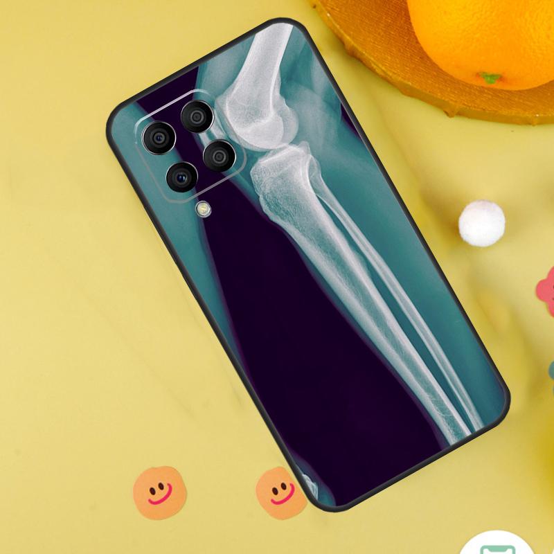 Чехол X-Ray Human Anatomy для Samsung Galaxy M54 M34 M14 M12 M32 M52 M53 M33 M13 M20 M21 M51 M15 M55 M31s M30s